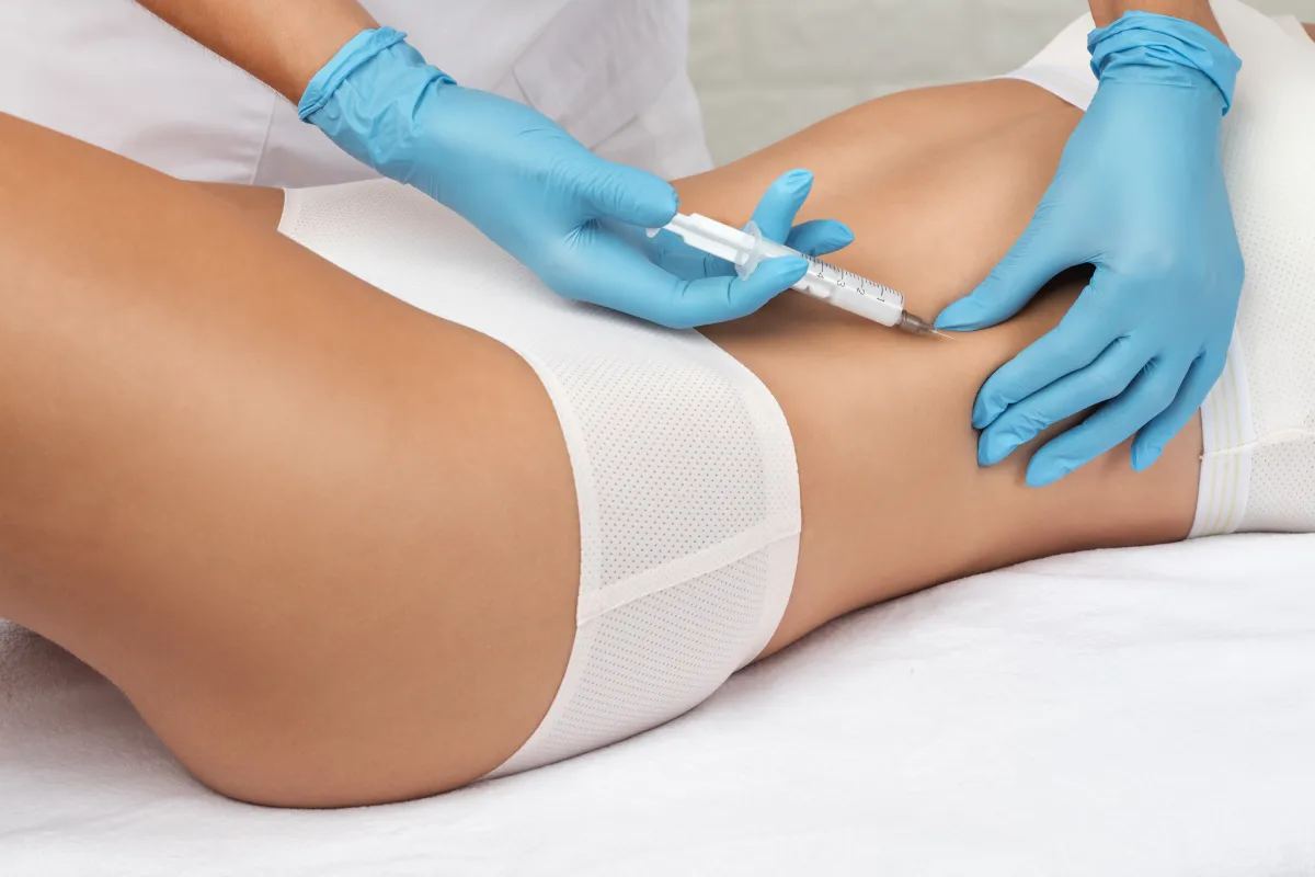 Inspo Medspa client lipo dissolve in Coral Springs FL