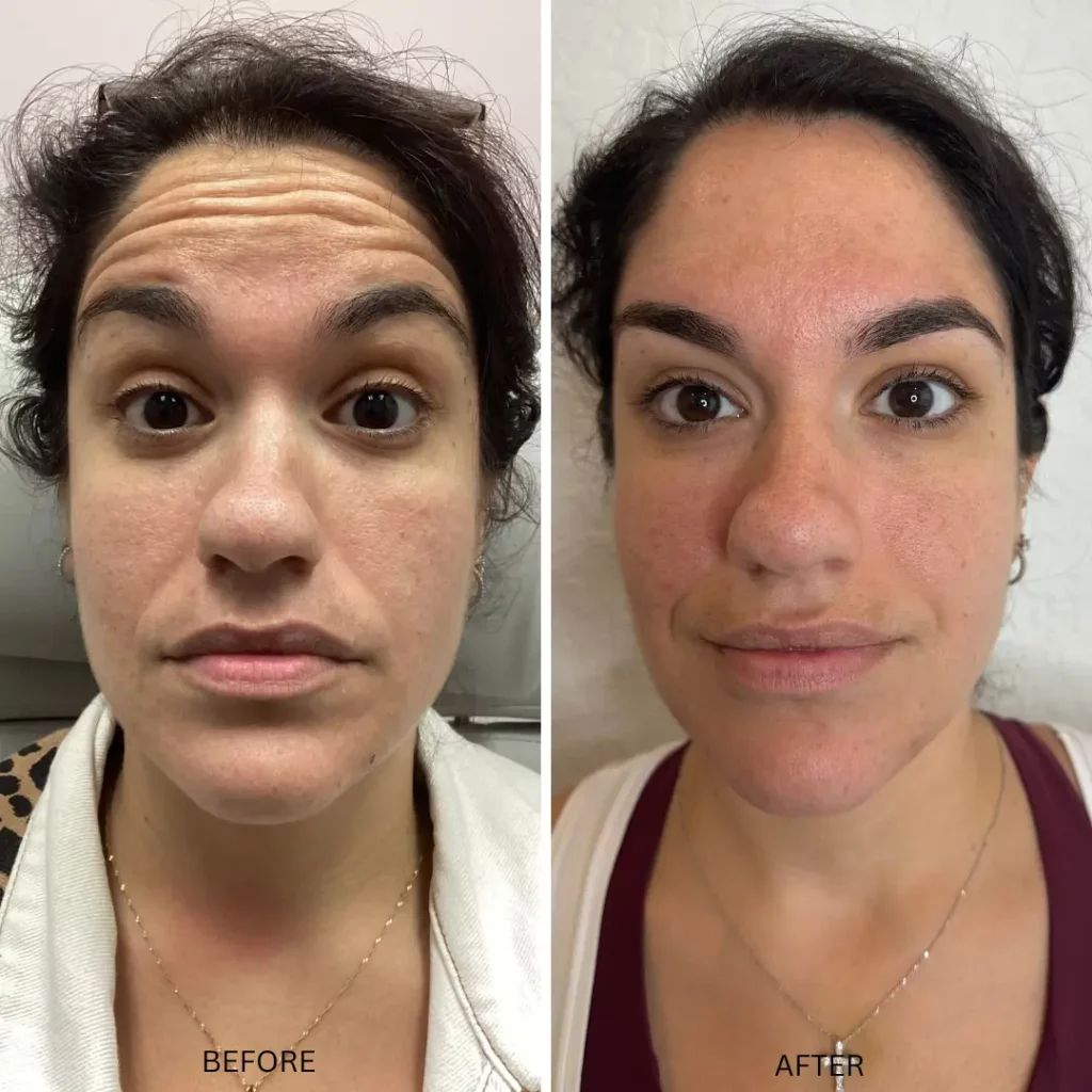 Medspa BA-Ab in Coral Springs FL