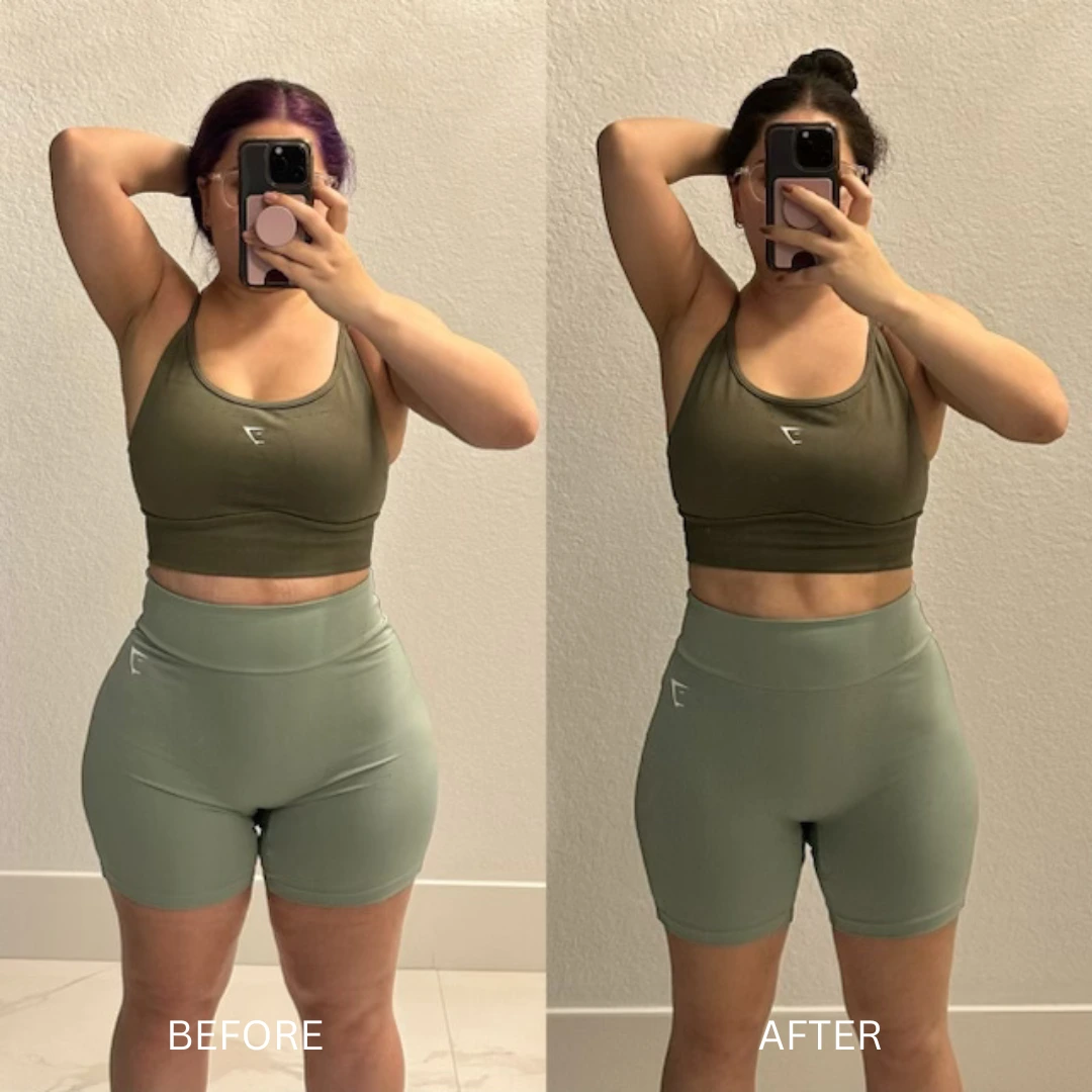 tirzepatide weight loss coral springs Medical Weight Loss Coral Springs