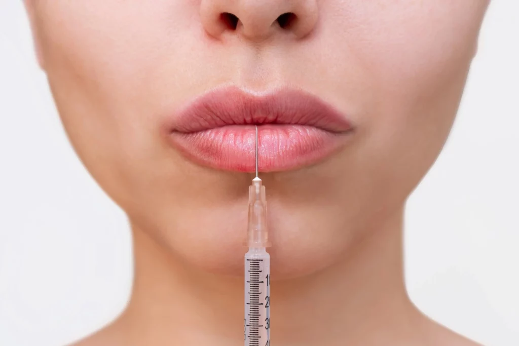 Full Face Refresh Coral Springs