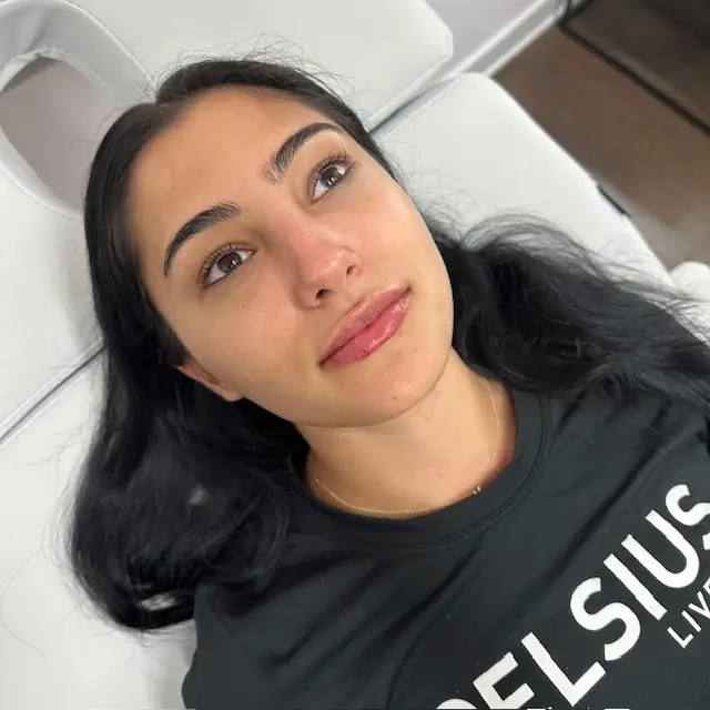 Inspo Medspa_Lip Filler gallery d in Coral Springs, FL