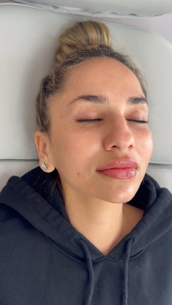 facial balancing in Deerfield Beach