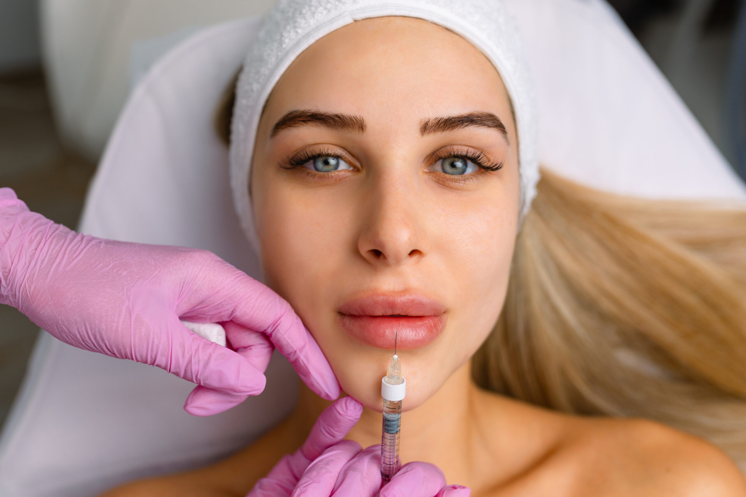 Lip Augmentation in Boca Raton