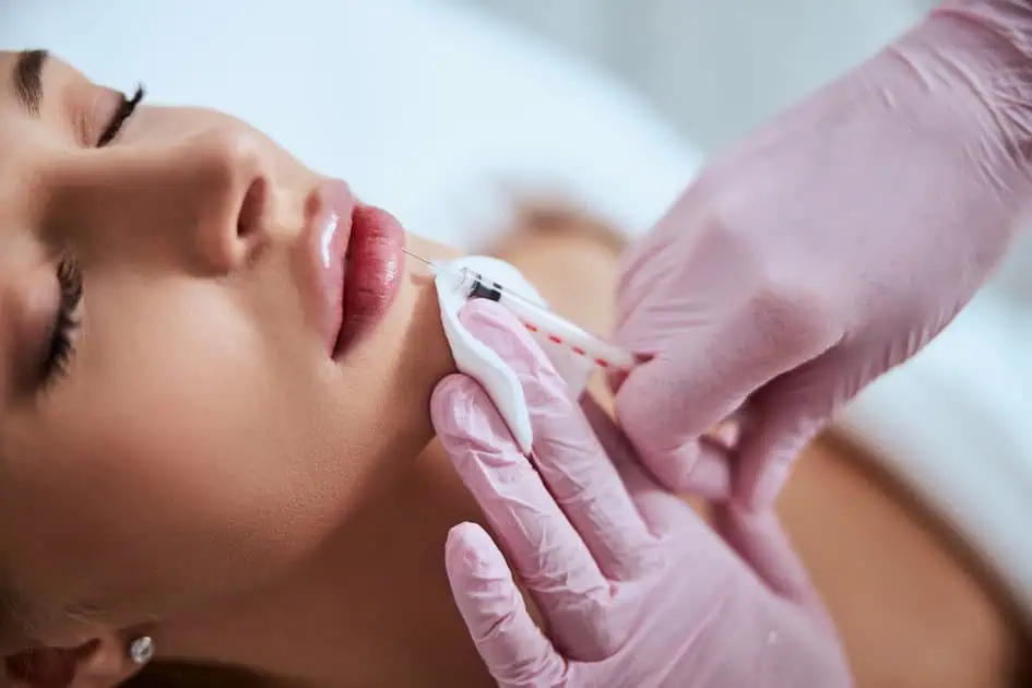 Lip filler injections for soft, natural-looking lips in Coral Springs